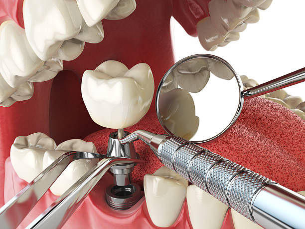 Best Knocked-Out Tooth Emergency  in Edina, MN
